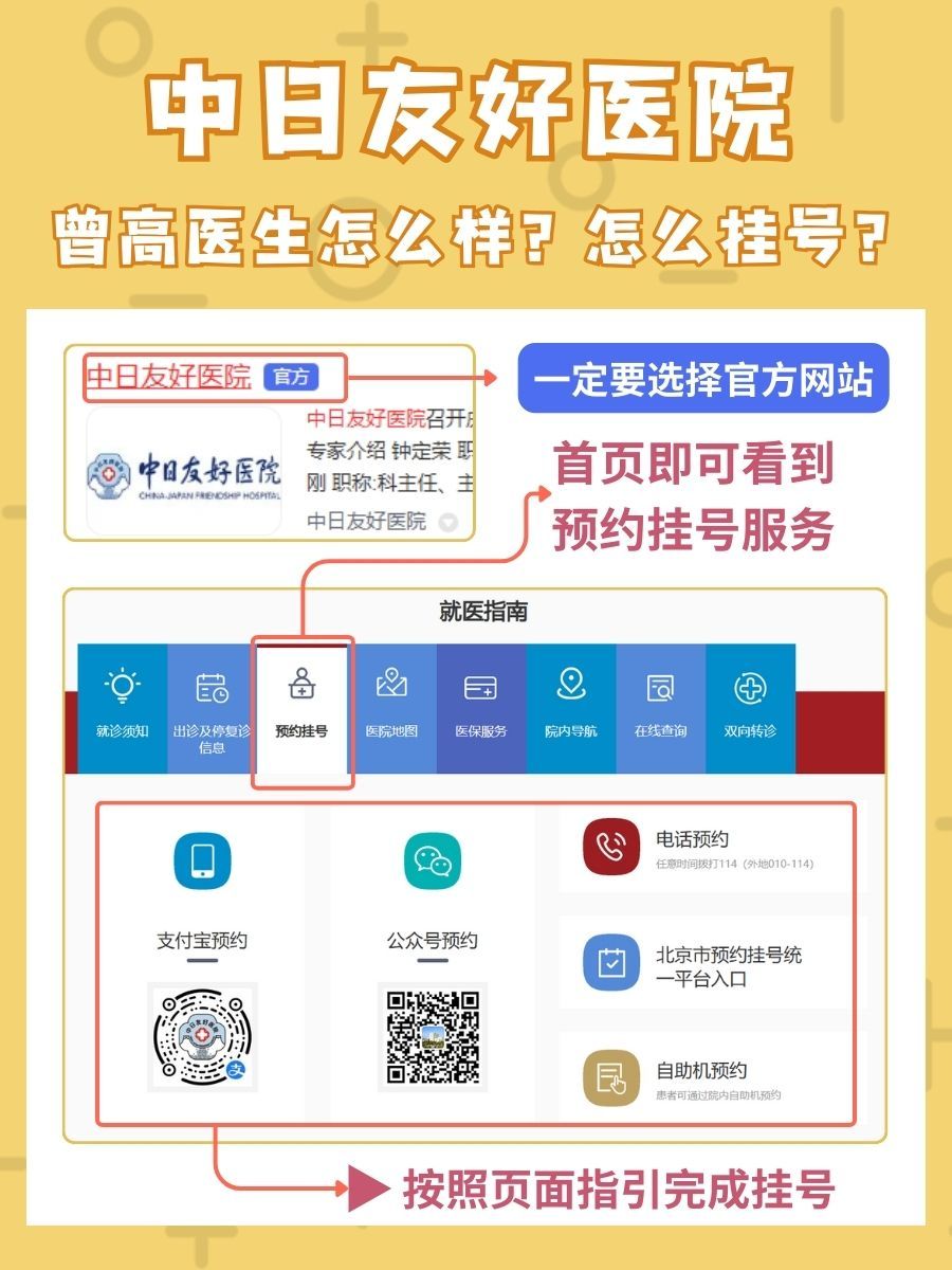 中日友好医院曾高医生怎么样？怎么挂号？