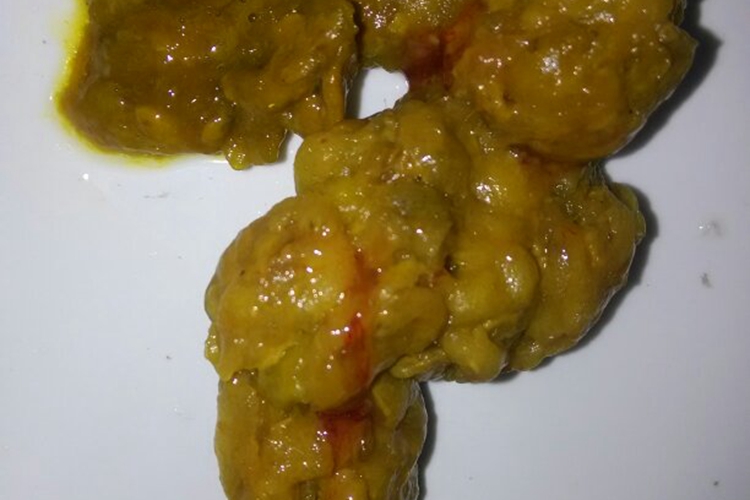 痔便中带血丝图