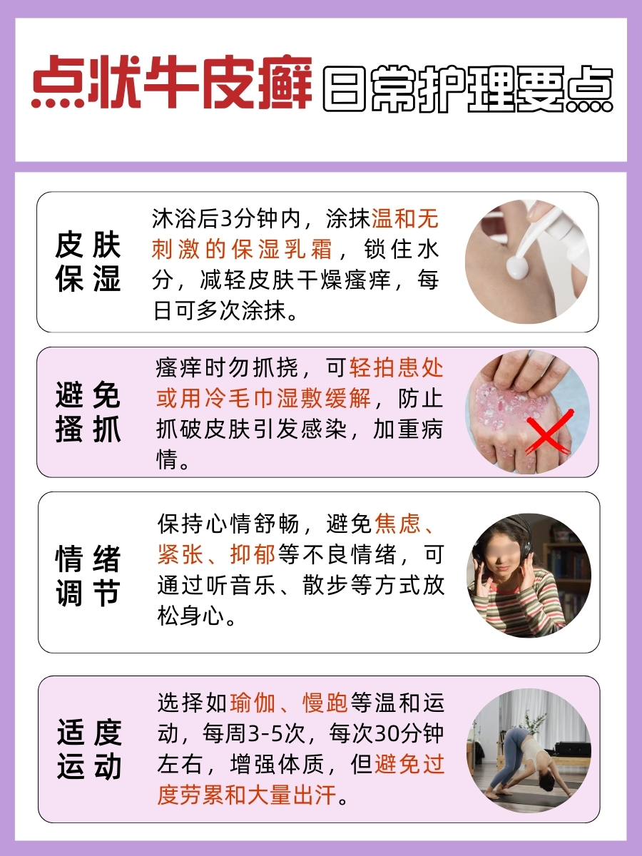 求解!点状牛皮癣用药后,多久能治愈?