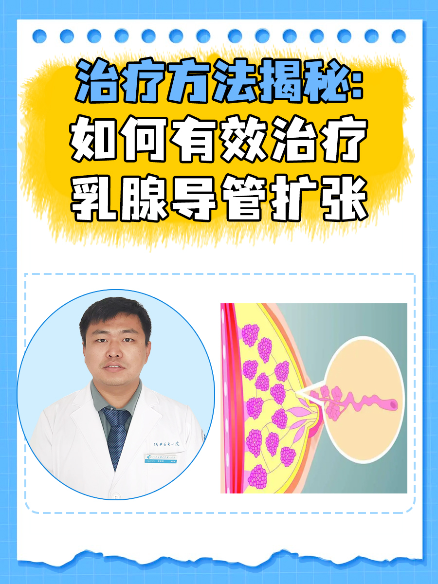 治疗方法揭秘：如何有效治疗乳腺导管扩张