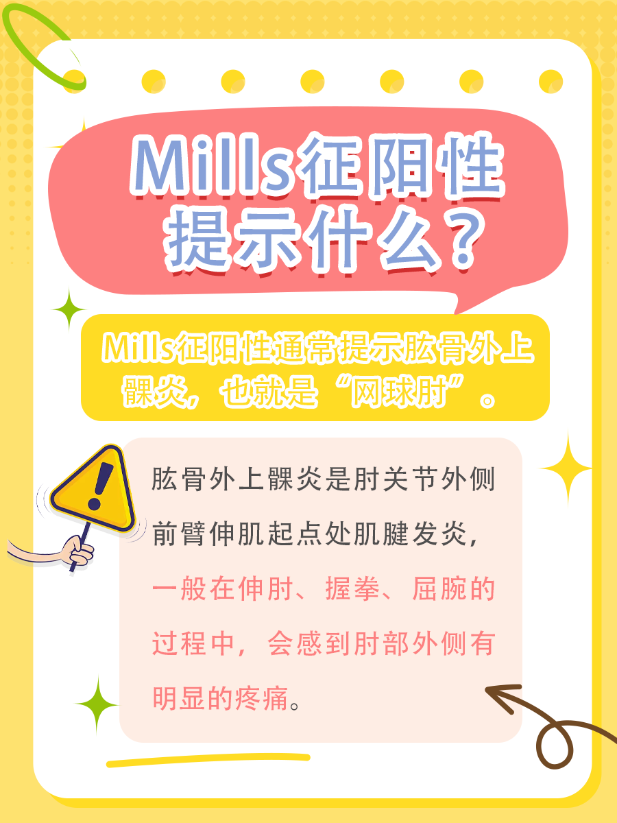 Mills征阳性：不容忽视的健康信号
