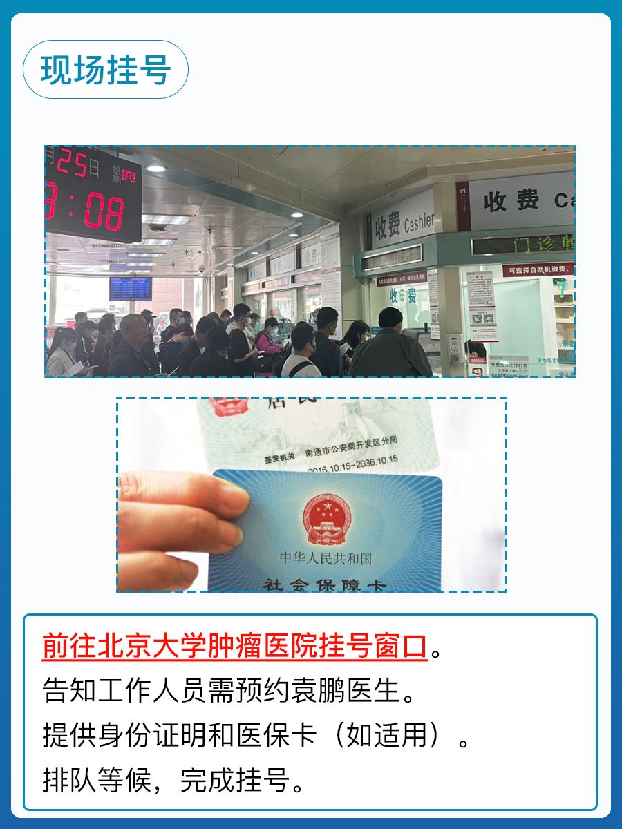 北京大学肿瘤医院袁鹏医生怎么样?怎么挂号?