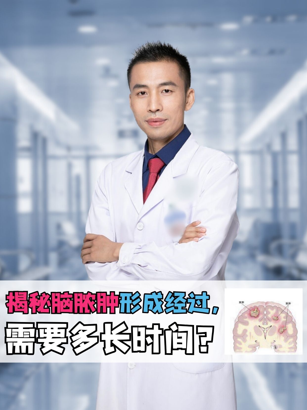 揭秘脑脓肿形成经过,需要多长时间?