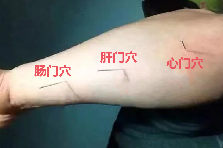 肠门肝门心门位置图