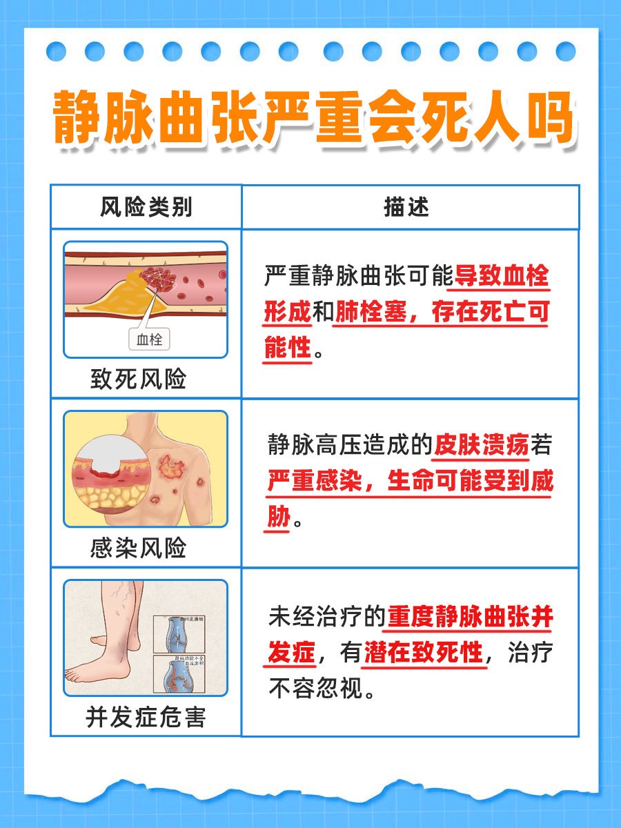 静脉曲张潜在危险：严重时可能危及生命吗？
