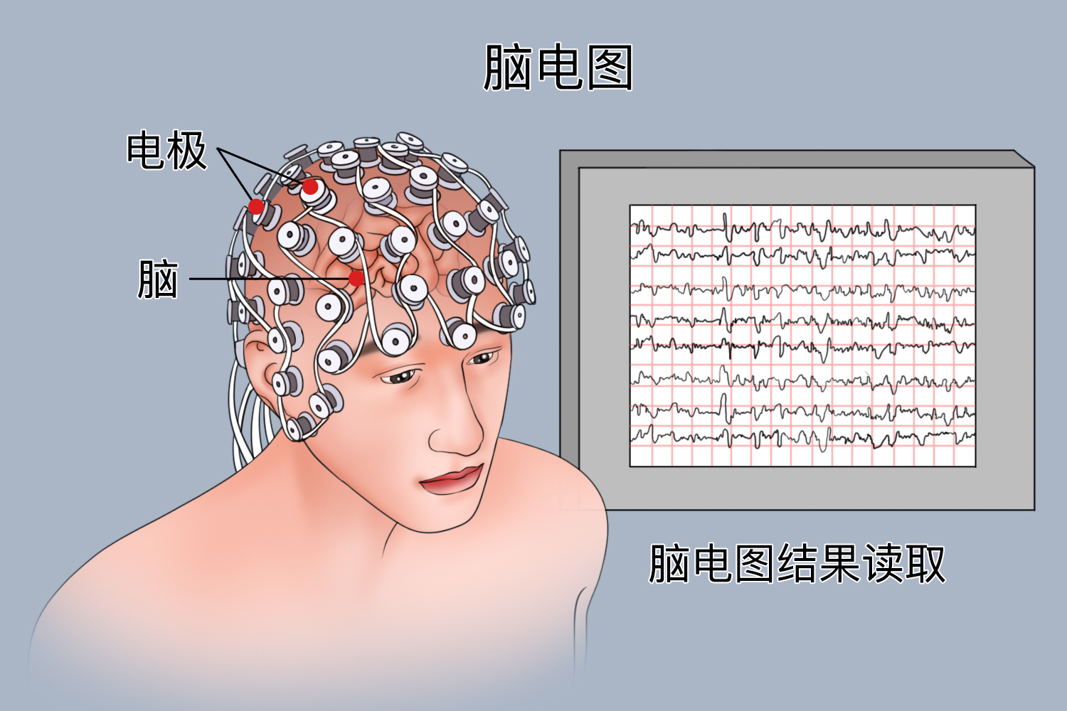 脑电图检查示意图 脑电图检查示意图