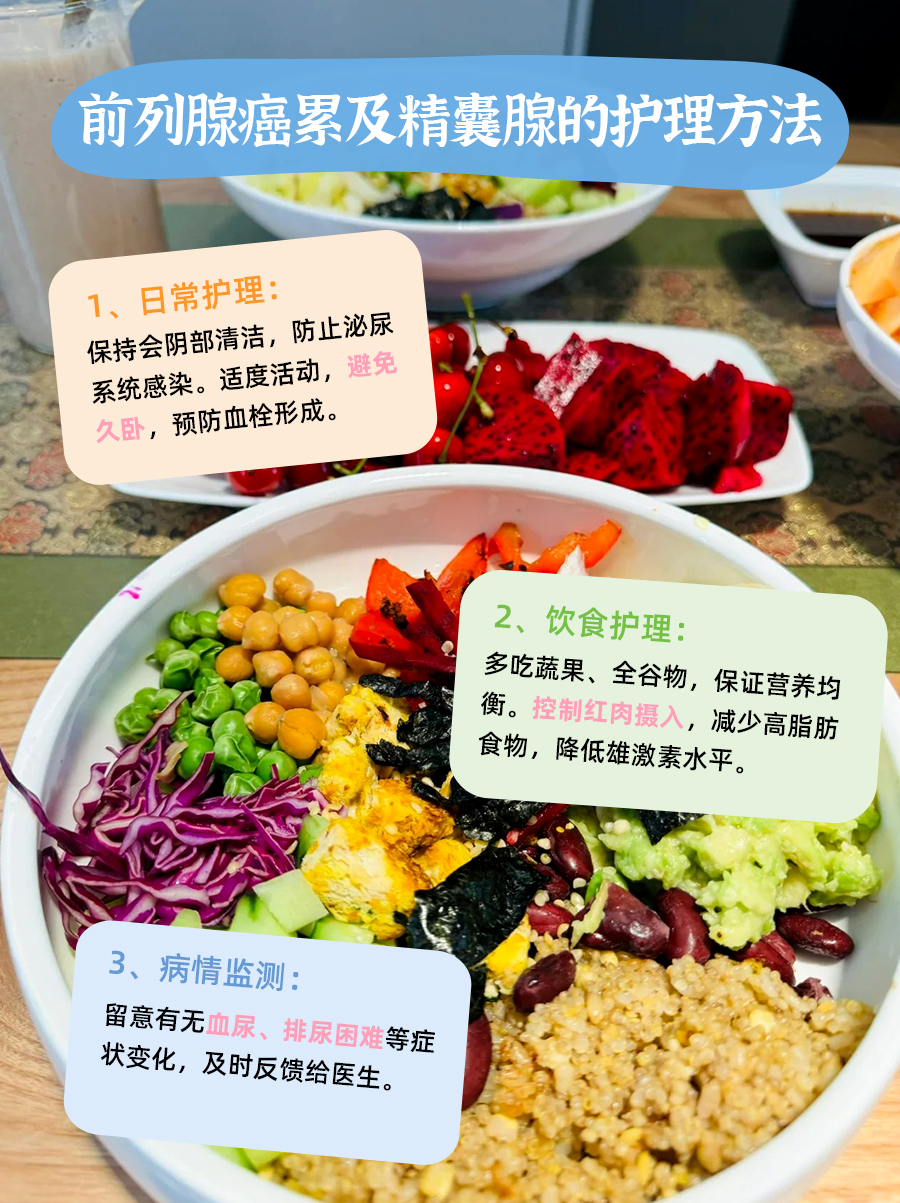 别忽视!前列腺癌累及精囊腺算转移吗?快瞧瞧