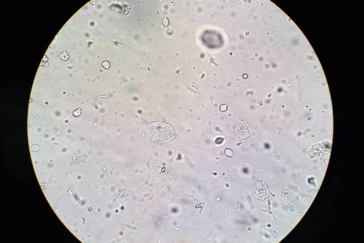 滴虫直接涂片图