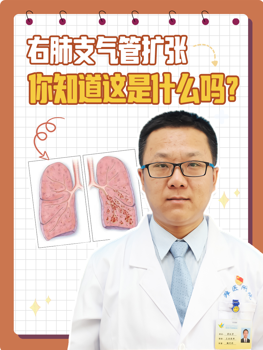 右肺支气管扩张,你知道这是什么吗?