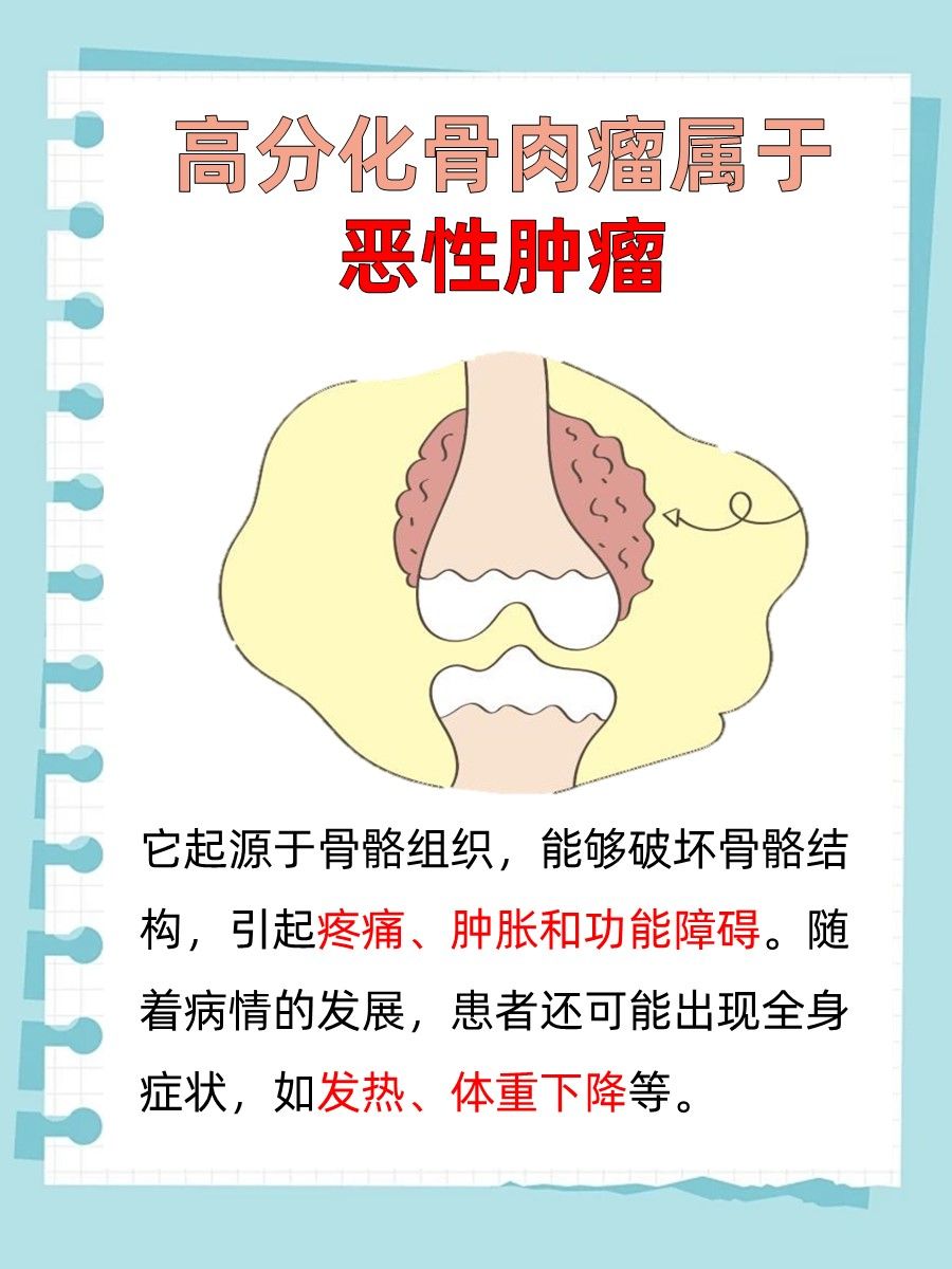 高分化骨肉瘤：恶性还是良性？一文说清！