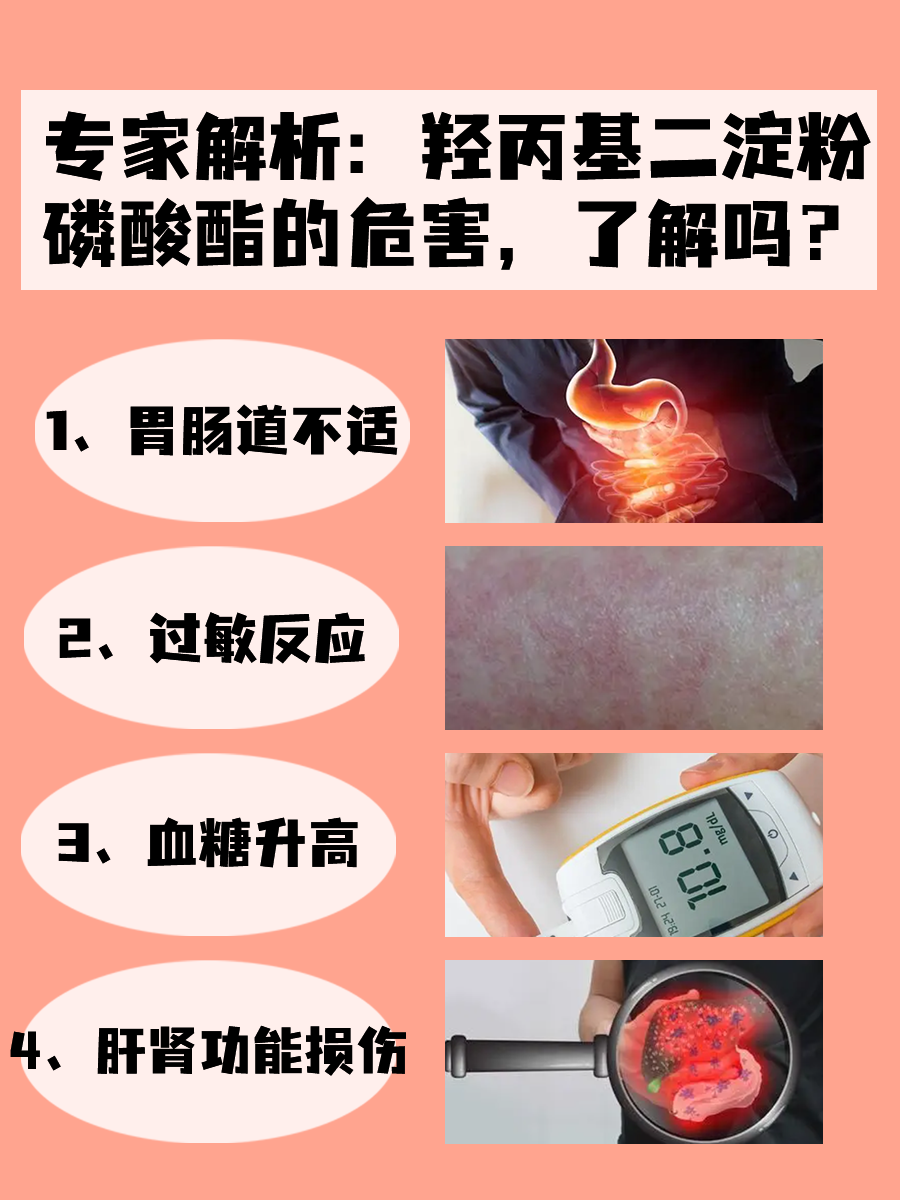 专家解析:羟丙基二淀粉磷酸酯的危害,了解吗?