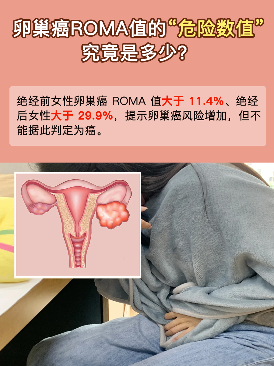 卵巢癌Roma值的“危险数值”，究竟是多少？