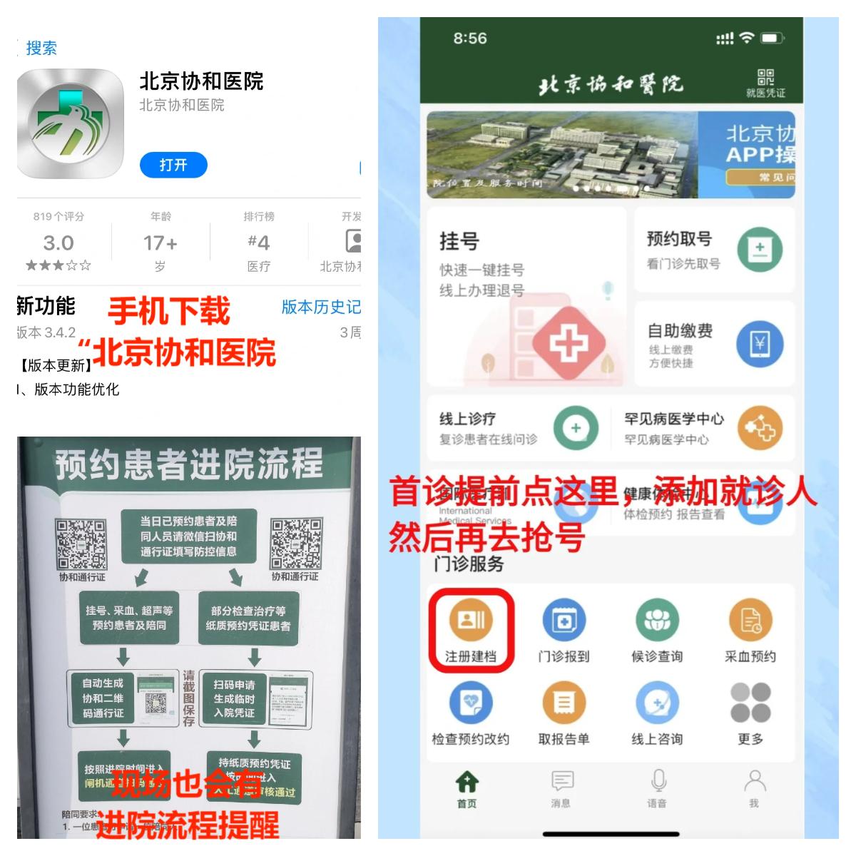 北京协和医院杨瑞平医生怎么样?怎么挂号?