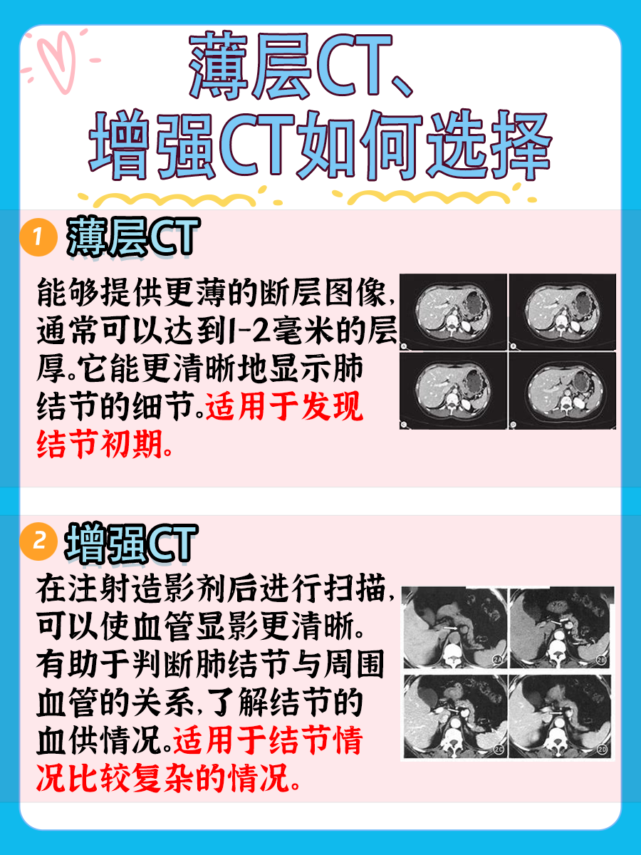医生回答：查肺结节做薄层CT还是增强CT