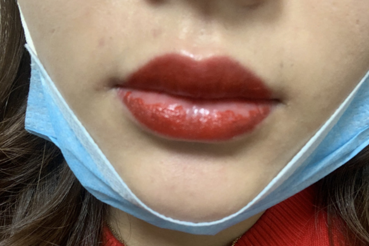 纹唇掉痂第一天图 纹唇掉痂第一天图