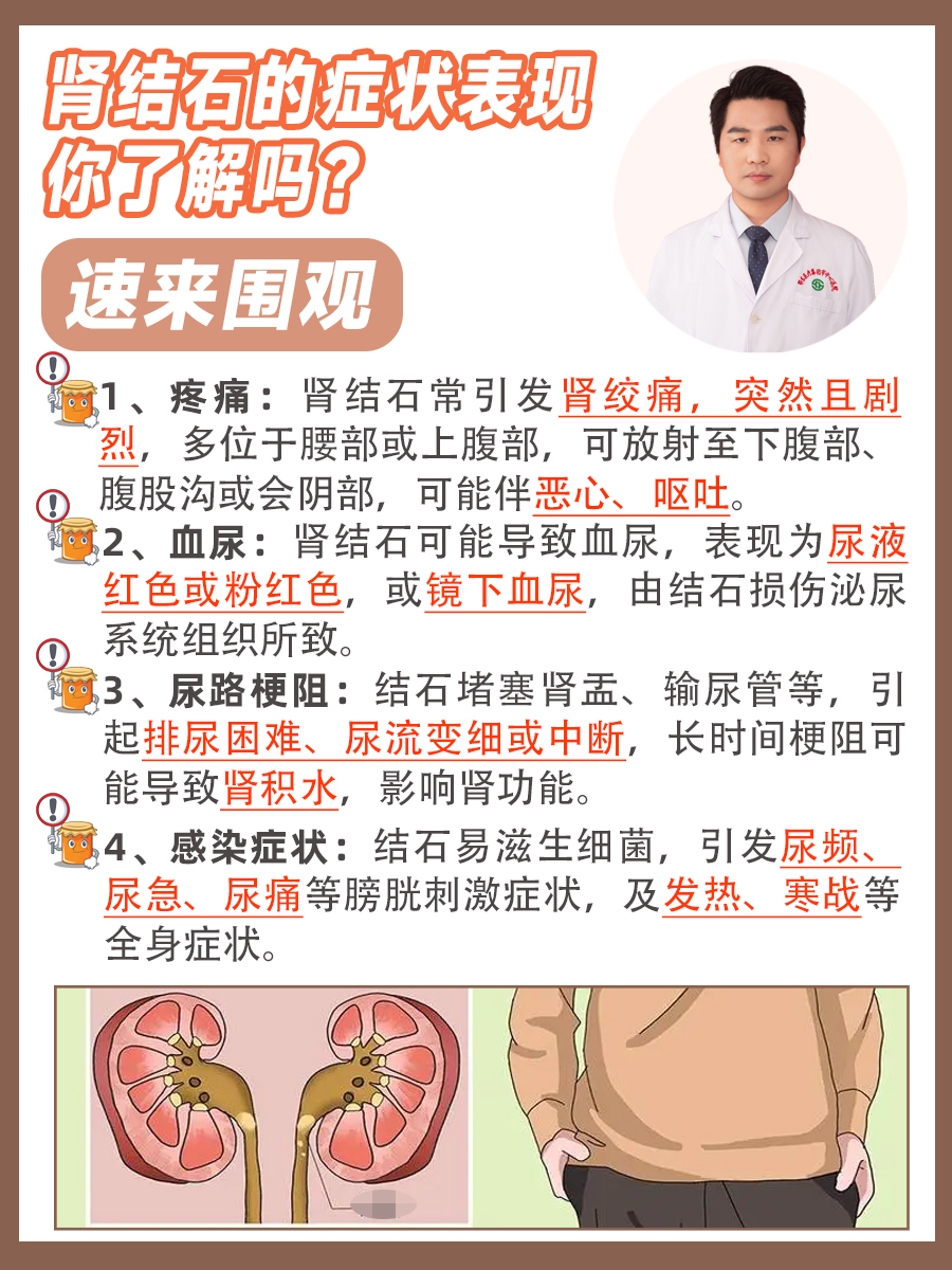 肾结石的症状表现你了解吗？速来围观