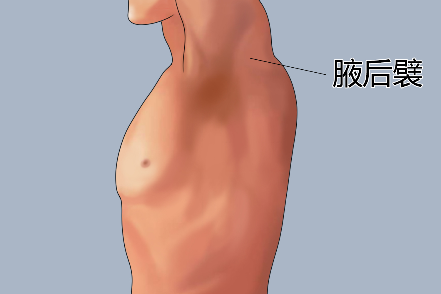 腋后襞图 腋后襞图
