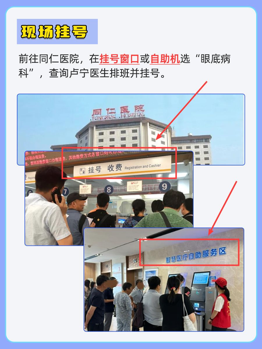 北京同仁医院卢宁医生怎么样？怎么挂号？