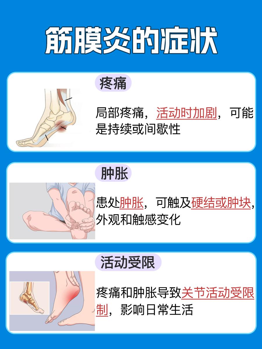 筋膜炎症状盘点,如何识别