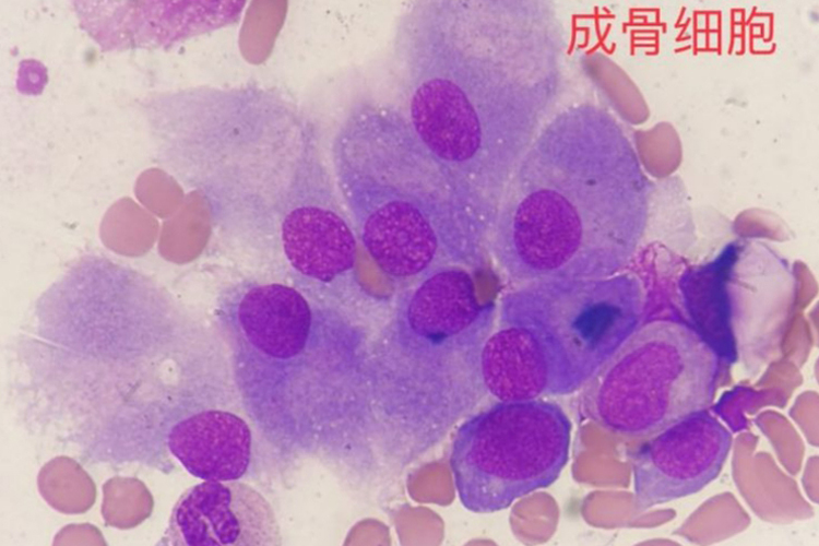 成骨细胞图 成骨细胞图