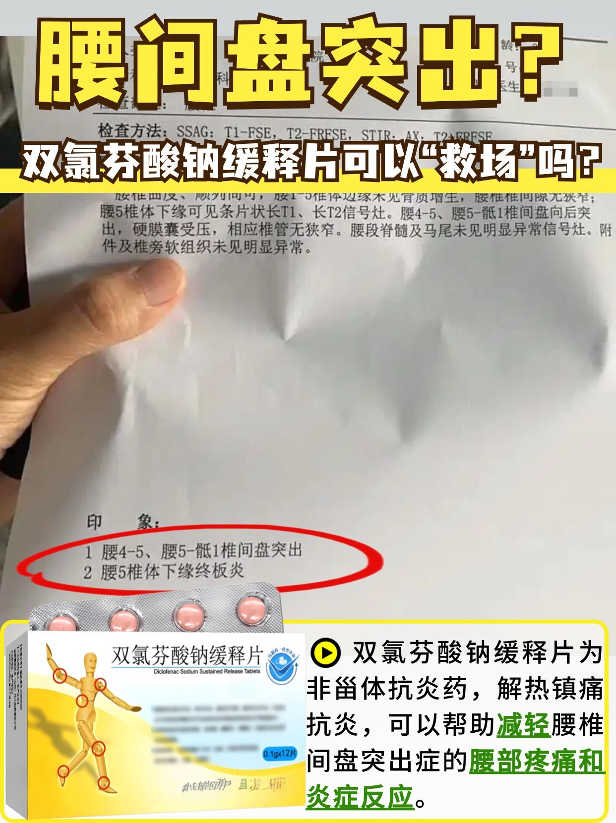 双氯灭痛治腰椎间盘突出症吗？医生有话说！
