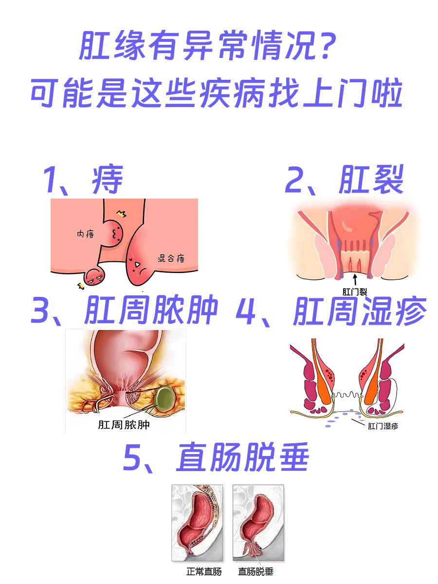 肛缘，究竟指的是身体的哪里？