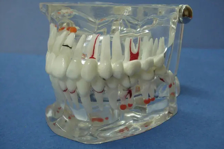 32颗恒牙正常排列图