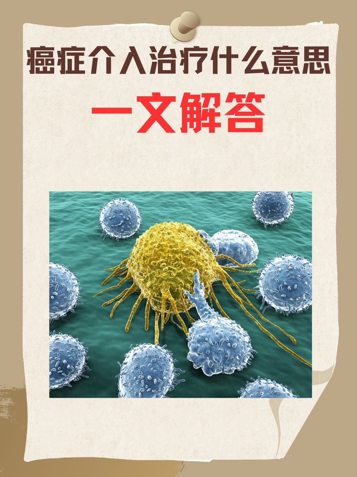 癌症介入治疗什么意思？一文解答
