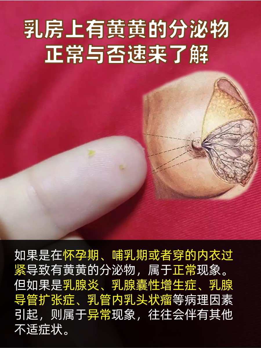 乳房上有黄黄的分泌物，正常与否速来了解