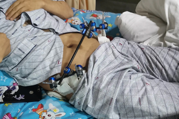 骶骨骨折正确睡姿图 骶骨骨折正确睡姿图