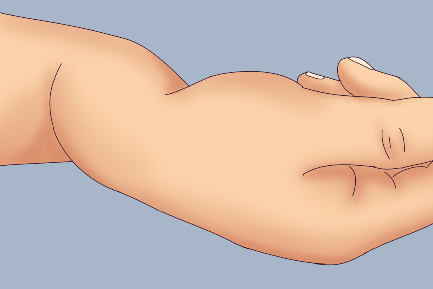 colles骨折餐叉样畸形图