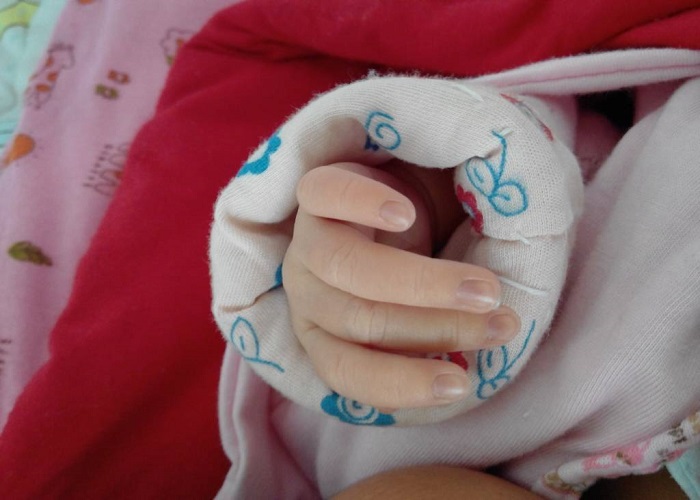 一个月宝宝手指末端发黑图