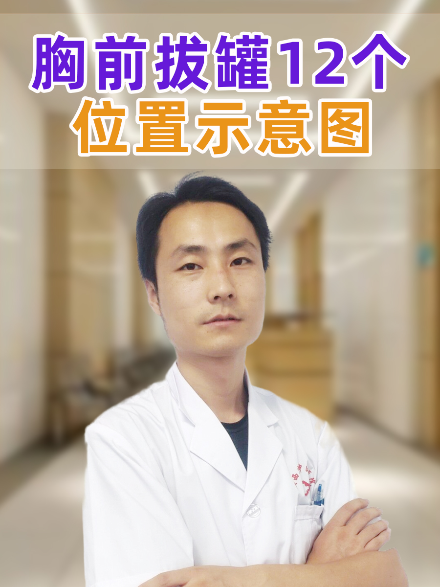 胸前拔罐12个位置示意图