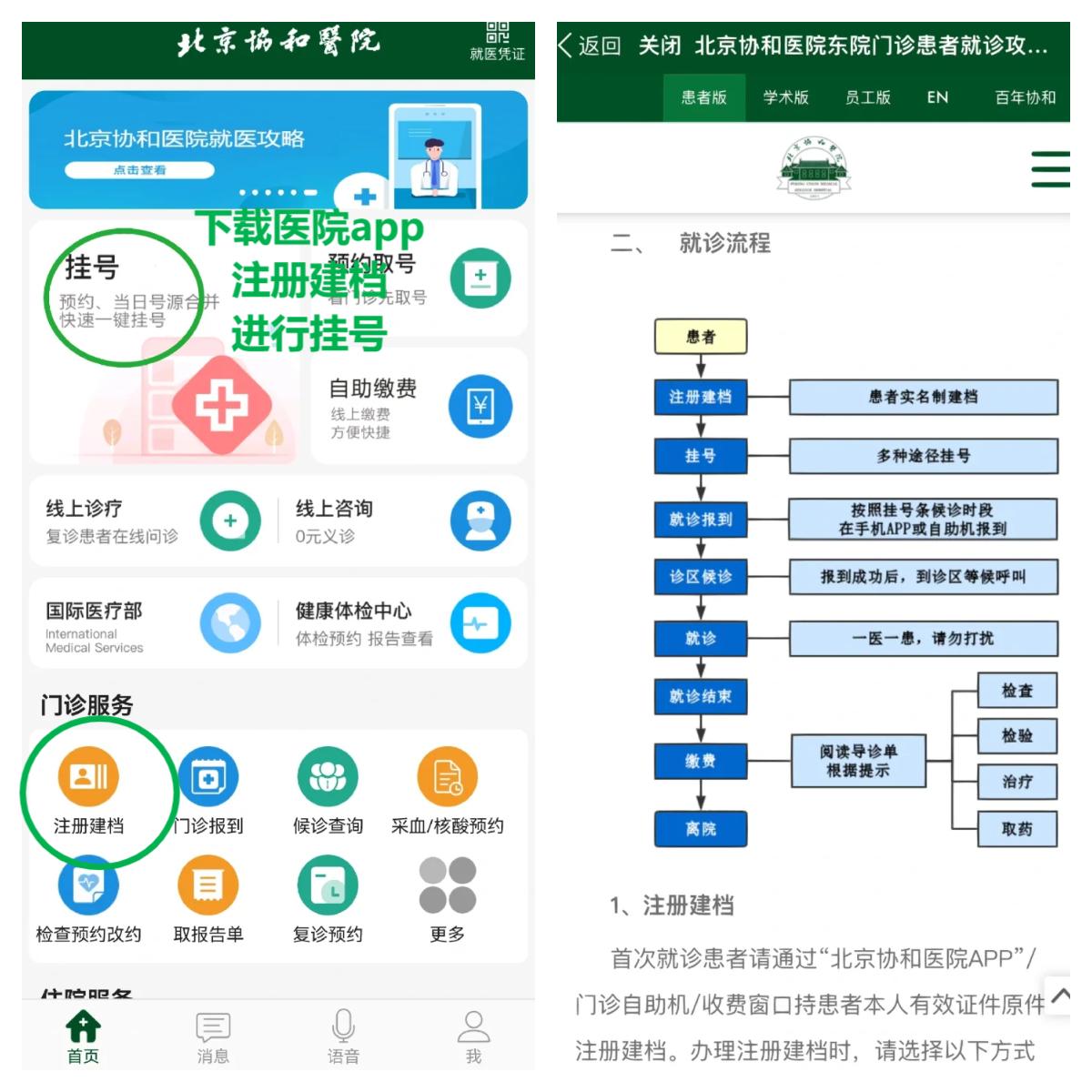 北京协和医院谢勇医生怎么样？怎么挂号？