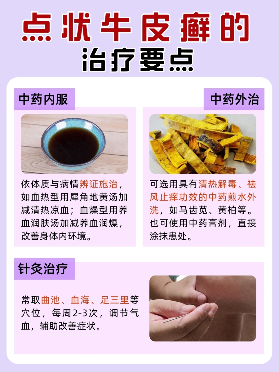 求解!点状牛皮癣用药后,多久能治愈?