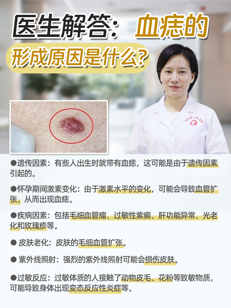 医生解答:血痣的形成原因是什么?