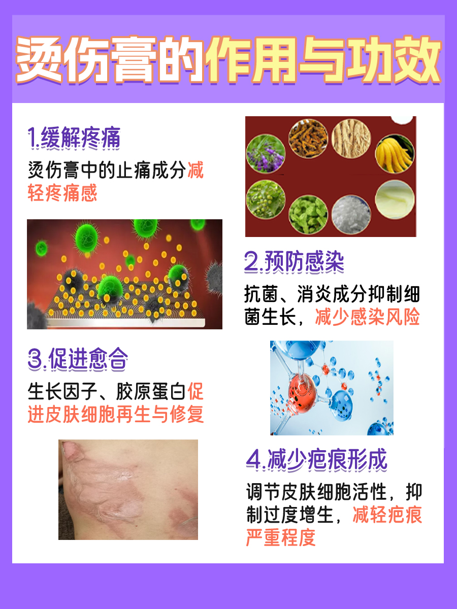 烫伤护理全攻略:烫伤膏的正确使用与日常护理