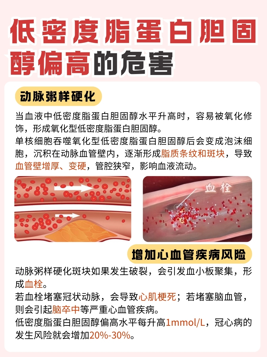 低密度脂蛋白胆固醇偏高怎么回事?诱因大起底