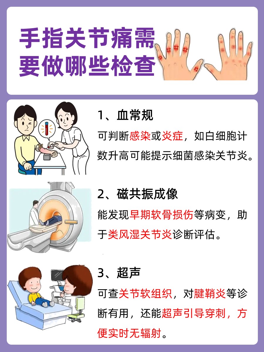 医生解答：手指关节痛用什么药
