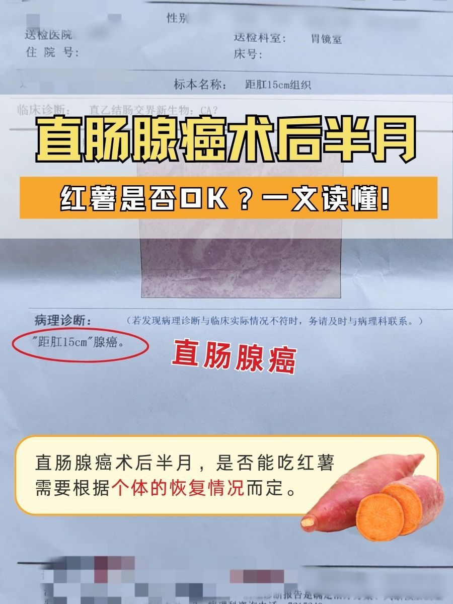 直肠腺癌术后半月,红薯是否OK?一文读懂!