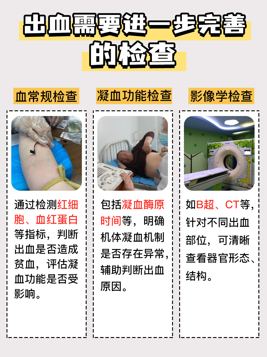 弄懂它！出血量三个分度很简单