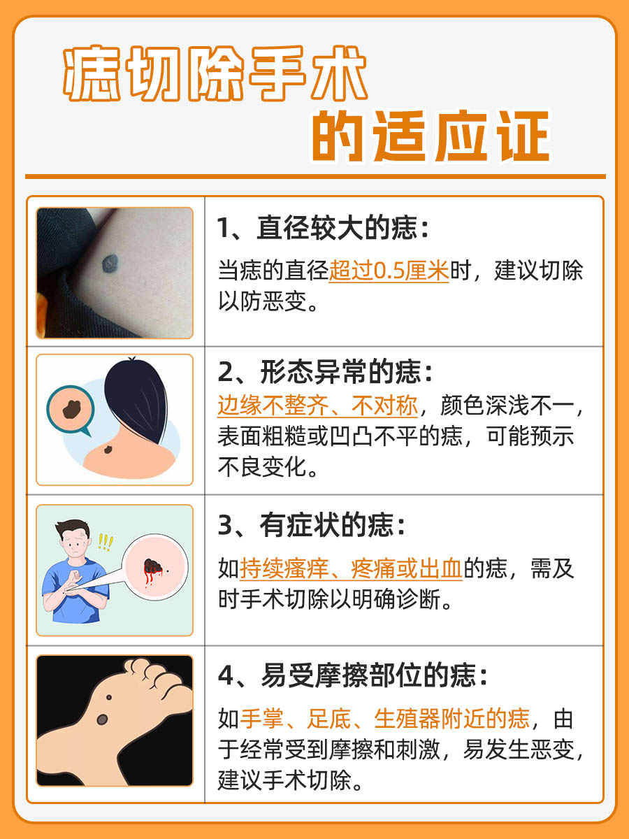 见证一颗痣的消失,了解切除痣的手术过程