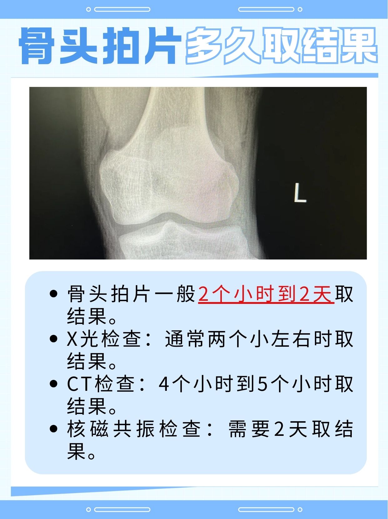 现在了解：骨头拍片子一般多长时间出来