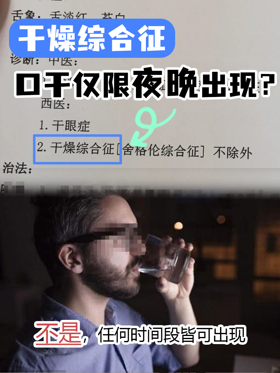 干燥综合征：口干仅限夜晚出现？