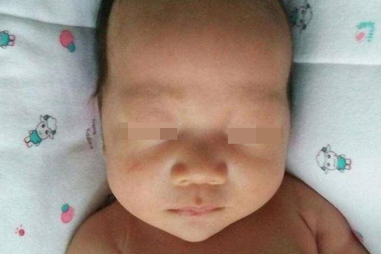 婴儿头被挤长图