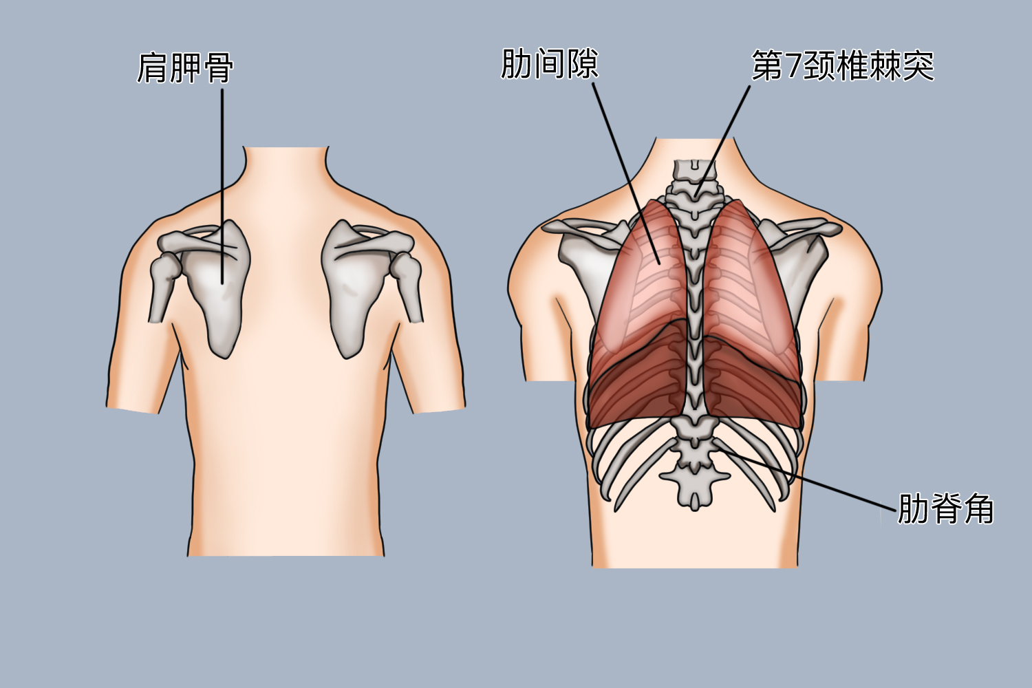 肋脊角压痛点位置图