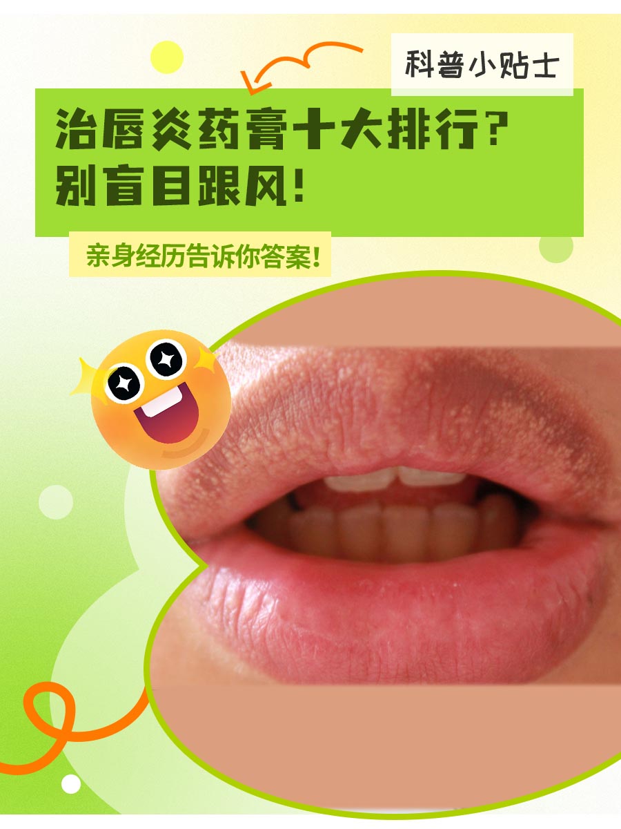 治唇炎药膏十大排行？别盲目跟风！