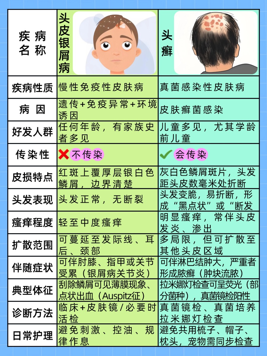 头皮银屑病的原因，你知道几个？