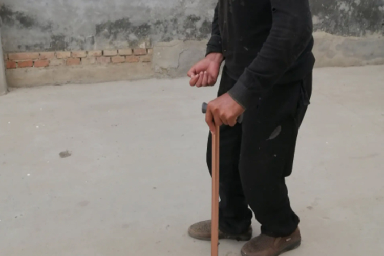 脑梗致偏瘫步态后遗症图 脑梗致偏瘫步态后遗症图