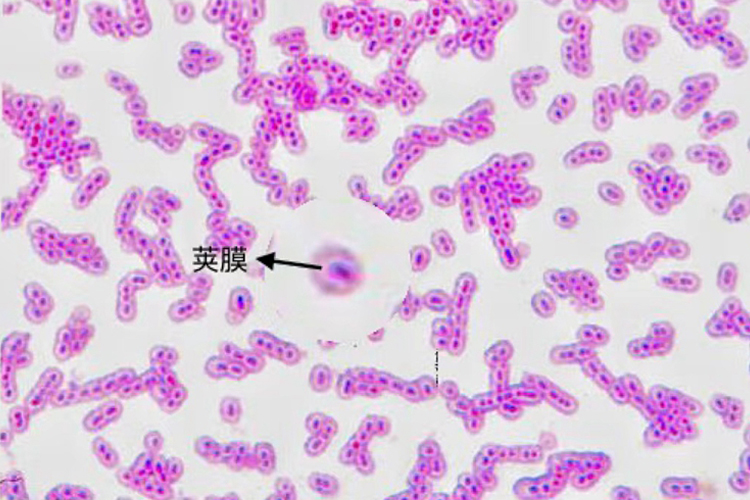 肺炎链球菌荚膜图 肺炎链球菌荚膜图